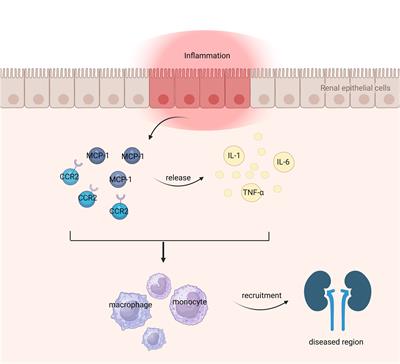 Role of MCP-1 as an inflammatory biomarker in nephropathy